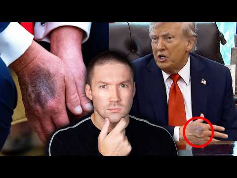 Is Donald Trump Dying?
